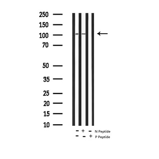 AR / Androgen Receptor Antibody - Western blot analysis of Androgen Phospho-Androgen Receptor (Ser650) expression in A549 whole cells lysates