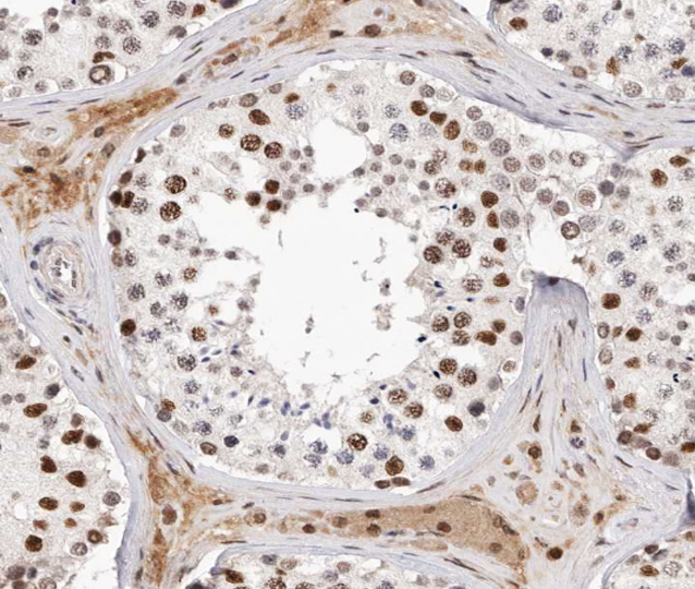 AR / Androgen Receptor Antibody - 1:200 staining human Testis tissue by IHC-P. The tissue was formaldehyde fixed and a heat mediated antigen retrieval step in citrate buffer was performed. The tissue was then blocked and incubated with the antibody for 1.5 hours at 22°C. An HRP conjugated goat anti-rabbit antibody was used as the secondary.