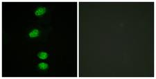AR / Androgen Receptor Antibody - Immunofluorescence analysis of HeLa cells, using Androgen Receptor (Phospho-Ser94) Antibody. The picture on the right is blocked with the phospho peptide.
