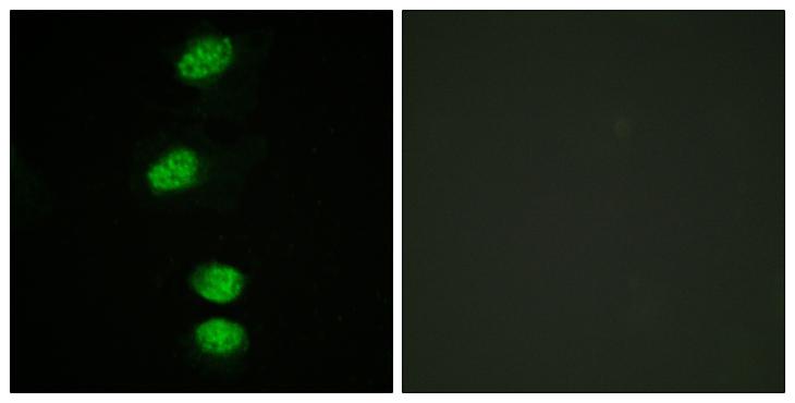 AR / Androgen Receptor Antibody - P-peptide - + Immunofluorescence analysis of HeLa cells, using Androgen Receptor (Phospho-Ser94) antibody.