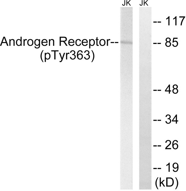 AR / Androgen Receptor Antibody - Western blot analysis of lysates from Jurkat cells treated with UV 15', using Androgen Receptor (Phospho-Tyr363) Antibody. The lane on the right is blocked with the phospho peptide.