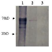 AR / Androgen Receptor Antibody - Immunodetection Analysis: Representative blot from a previous lot. Lane 1.Androgen receptor protein ?g; Lane 2.MCF7 cell lysate ; Lane 3.BSA 2?g. The membrane blot was probed with anti-Androgen receptor primary antibody(0.25?g/ml). Proteins were visualized using a goat anti-rabbit secondary antibody conjugated to HRP and chemiluminescence detection system. Arrows indicate cellular androgen receptor from human cells (70-80 kDa).