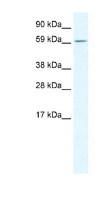 ARA55 / HIC-5 Antibody - TGFB1I1 / HIC-5 antibody Western blot of Fetal lung lysate. This image was taken for the unconjugated form of this product. Other forms have not been tested.