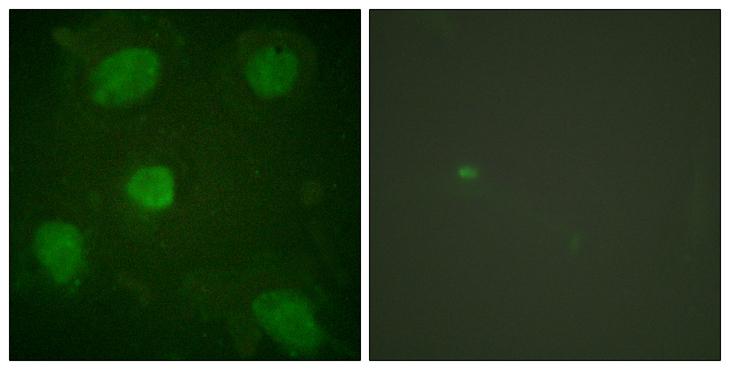 ARA55 / HIC-5 Antibody - Peptide - + Immunofluorescence analysis of HeLa cells, treated with TNF-a (20nM, 15mins), using HIC-5 antibody.