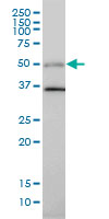 ARA55 / HIC-5 Antibody - TGFB1I1 monoclonal antibody (M01), clone 4B2-D8 Western Blot analysis of TGFB1I1 expression in HeLa.