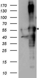 ARA55 / HIC-5 Antibody - HEK293T cells were transfected with the pCMV6-ENTRY control. (Left lane) or pCMV6-ENTRY TGFB1I1. (Right lane) cDNA for 48 hrs and lysed