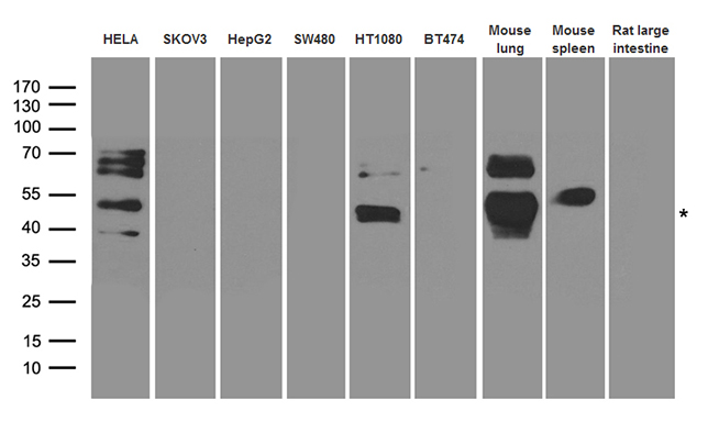 ARA55 / HIC-5 Antibody - Western blot analysis of extracts. (35ug) from different cell lines and tissues by using anti-TGFB1I1 rabbit polyclonal antibody.
