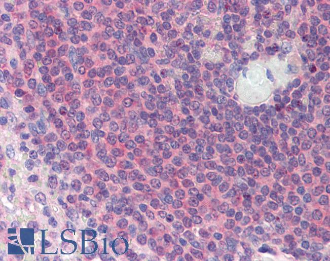 ARA55 / HIC-5 Antibody - Anti-TGFB1I1 / HIC-5 antibody IHC of human spleen. Immunohistochemistry of formalin-fixed, paraffin-embedded tissue after heat-induced antigen retrieval. Antibody concentration 5 ug/ml.  This image was taken for the unconjugated form of this product. Other forms have not been tested.