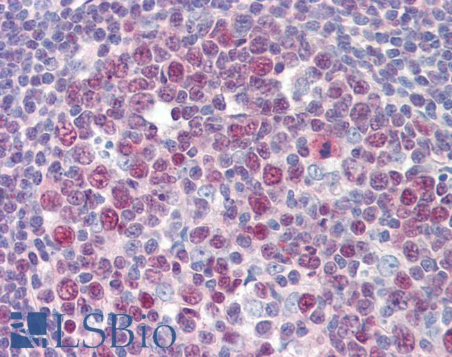 ARA55 / HIC-5 Antibody - Anti-TGFB1I1 / HIC-5 antibody IHC of human tonsil. Immunohistochemistry of formalin-fixed, paraffin-embedded tissue after heat-induced antigen retrieval. Antibody concentration 5 ug/ml.  This image was taken for the unconjugated form of this product. Other forms have not been tested.
