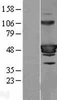ARA55 / HIC-5 Protein - Western validation with an anti-DDK antibody * L: Control HEK293 lysate R: Over-expression lysate