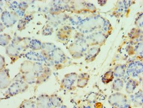 ARA70 / NCOA4 Antibody - Immunohistochemistry of paraffin-embedded human pancreas using antibody at 1:100 dilution.