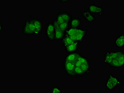 ARA70 / NCOA4 Antibody - Immunofluorescent analysis of MCF-7 cells using NCOA4 Antibody at dilution of 1:100 and Alexa Fluor 488-congugated AffiniPure Goat Anti-Rabbit IgG(H+L)