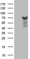 ARA70 / NCOA4 Antibody - HEK293T cells were transfected with the pCMV6-ENTRY control (Left lane) or pCMV6-ENTRY NCOA4 (Right lane) cDNA for 48 hrs and lysed. Equivalent amounts of cell lysates (5 ug per lane) were separated by SDS-PAGE and immunoblotted with anti-NCOA4.
