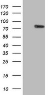 ARA70 / NCOA4 Antibody - HEK293T cells were transfected with the pCMV6-ENTRY control (Left lane) or pCMV6-ENTRY NCOA4 (Right lane) cDNA for 48 hrs and lysed. Equivalent amounts of cell lysates (5 ug per lane) were separated by SDS-PAGE and immunoblotted with anti-NCOA4.