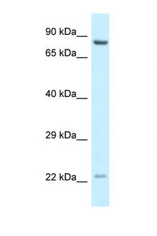 ARA70 / NCOA4 Antibody - NCOA4 antibody Western blot of MCF7 Cell lysate. Antibody concentration 1 ug/ml.  This image was taken for the unconjugated form of this product. Other forms have not been tested.