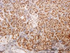 ARA70 / NCOA4 Antibody - Immunoperoxidase of monoclonal antibody to NCOA4 on formalin-fixed paraffin-embedded human pancreas. [antibody concentration 3 ug/ml]