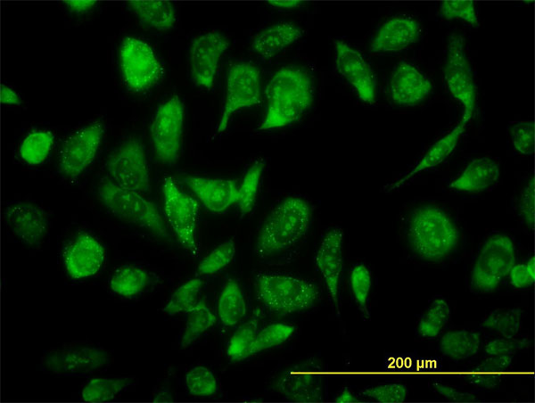 ARA70 / NCOA4 Antibody - Immunofluorescence of monoclonal antibody to NCOA4 on HeLa cell. [antibody concentration 10 ug/ml]
