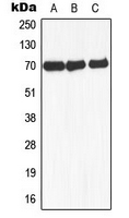 ARA70 / NCOA4 Antibody - Western blot analysis of NCOA4 expression in MCF7 (A); mouse liver (B); rat lung (C) whole cell lysates.