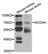 ARA70 / NCOA4 Antibody - Western blot analysis of extracts of various cell lines, using NCOA4 antibody.