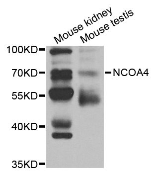 ARA70 / NCOA4 Antibody - Western blot analysis of extracts of various cell lines, using NCOA4 antibody.