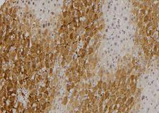 ARA70 / NCOA4 Antibody - 1:100 staining rat liver tissue by IHC-P. The sample was formaldehyde fixed and a heat mediated antigen retrieval step in citrate buffer was performed. The sample was then blocked and incubated with the antibody for 1.5 hours at 22°C. An HRP conjugated goat anti-rabbit antibody was used as the secondary.