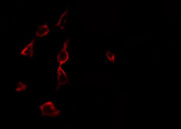 ARA70 / NCOA4 Antibody - Staining 293 cells by IF/ICC. The samples were fixed with PFA and permeabilized in 0.1% Triton X-100, then blocked in 10% serum for 45 min at 25°C. The primary antibody was diluted at 1:200 and incubated with the sample for 1 hour at 37°C. An Alexa Fluor 594 conjugated goat anti-rabbit IgG (H+L) Ab, diluted at 1/600, was used as the secondary antibody.