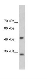 ARA9 / AIP Antibody - HepG2 Cell Lysate.  This image was taken for the unconjugated form of this product. Other forms have not been tested.