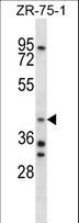 ARA9 / AIP Antibody - AIP Antibody western blot of ZR-75-1 cell line lysates (35 ug/lane). The AIP antibody detected the AIP protein (arrow).