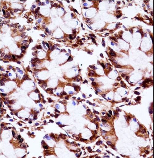 ARA9 / AIP Antibody - AIP Antibody immunohistochemistry of formalin-fixed and paraffin-embedded human rectum tissue followed by peroxidase-conjugated secondary antibody and DAB staining.