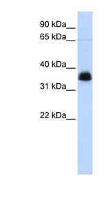ARA9 / AIP Antibody - AIP antibody Western blot of Jurkat lysate. This image was taken for the unconjugated form of this product. Other forms have not been tested.