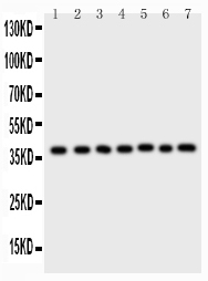 ARA9 / AIP Antibody - Western blot - Anti-ARA9 Picoband Antibody