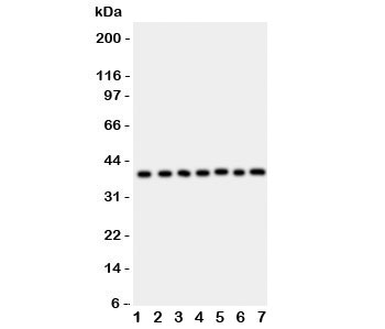 ARA9 / AIP Antibody - Western blot testing of ARA9 antibody and Lane 1: HeLa; 2: COLO320; 3: HT1080; 4: MCF-7; 5: SW620; 6: U87; 7: MM231; Predicted/Observed size: 37KD