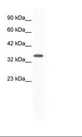 ARA9 / AIP Antibody - Jurkat Cell Lysate.  This image was taken for the unconjugated form of this product. Other forms have not been tested.