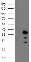 ARA9 / AIP Antibody - HEK293T cells were transfected with the pCMV6-ENTRY control (Left lane) or pCMV6-ENTRY AIP (Right lane) cDNA for 48 hrs and lysed. Equivalent amounts of cell lysates (5 ug per lane) were separated by SDS-PAGE and immunoblotted with anti-AIP.