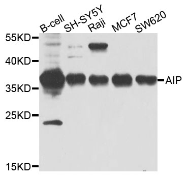 ARA9 / AIP Antibody - Western blot analysis of extracts of various cells.