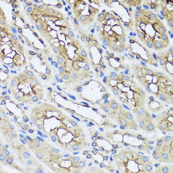 ARA9 / AIP Antibody - Immunohistochemistry of paraffin-embedded mouse kidney tissue.