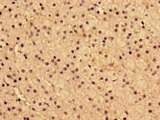 ARA9 / AIP Antibody - Immunohistochemistry image of paraffin-embedded human adrenal gland tissue at a dilution of 1:100