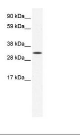 ARA9 / AIP Antibody - NIH 3T3 Cell Lysate.  This image was taken for the unconjugated form of this product. Other forms have not been tested.