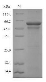 ADH5 Protein - (Tris-Glycine gel) Discontinuous SDS-PAGE (reduced) with 5% enrichment gel and 15% separation gel.