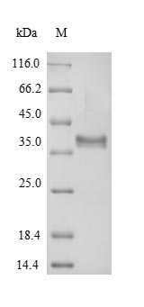 AER1 Protein - (Tris-Glycine gel) Discontinuous SDS-PAGE (reduced) with 5% enrichment gel and 15% separation gel.