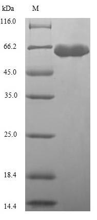 ALS (A. thaliana) Protein - (Tris-Glycine gel) Discontinuous SDS-PAGE (reduced) with 5% enrichment gel and 15% separation gel.