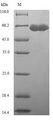 ALS (A. thaliana) Protein - (Tris-Glycine gel) Discontinuous SDS-PAGE (reduced) with 5% enrichment gel and 15% separation gel.
