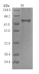 DME Protein - (Tris-Glycine gel) Discontinuous SDS-PAGE (reduced) with 5% enrichment gel and 15% separation gel.