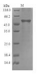 DME Protein - (Tris-Glycine gel) Discontinuous SDS-PAGE (reduced) with 5% enrichment gel and 15% separation gel.