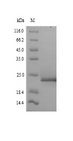 FACT Complex Subunit SPT16 Protein - (Tris-Glycine gel) Discontinuous SDS-PAGE (reduced) with 5% enrichment gel and 15% separation gel.