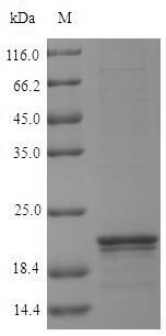 LYSMD1 Protein - (Tris-Glycine gel) Discontinuous SDS-PAGE (reduced) with 5% enrichment gel and 15% separation gel.