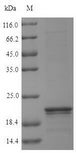 LYSMD1 Protein - (Tris-Glycine gel) Discontinuous SDS-PAGE (reduced) with 5% enrichment gel and 15% separation gel.
