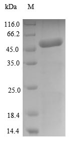 PCMP-H63 Protein - (Tris-Glycine gel) Discontinuous SDS-PAGE (reduced) with 5% enrichment gel and 15% separation gel.