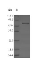 ROS1  /  DML1  (a. thaliana) Protein - (Tris-Glycine gel) Discontinuous SDS-PAGE (reduced) with 5% enrichment gel and 15% separation gel.