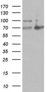 ARAF / ARAF1 / A-RAF Antibody - HEK293T cells were transfected with the pCMV6-ENTRY control (Left lane) or pCMV6-ENTRY ARAF (Right lane) cDNA for 48 hrs and lysed. Equivalent amounts of cell lysates (5 ug per lane) were separated by SDS-PAGE and immunoblotted with anti-ARAF.